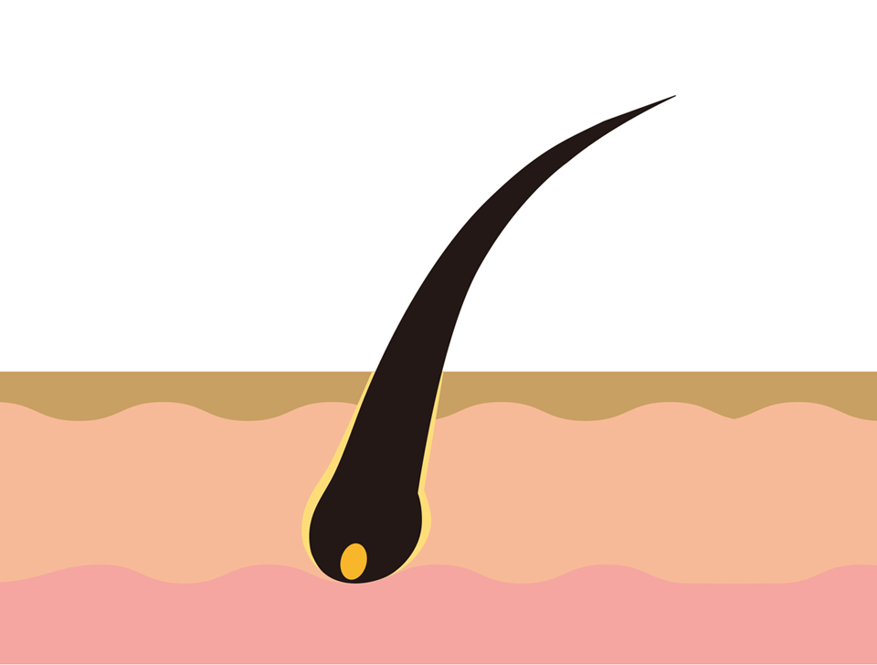 私はこうして薄毛を治療した