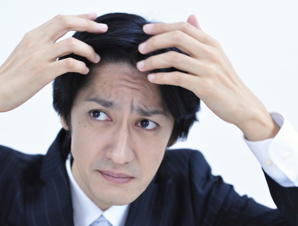 薄毛の原因とは？
