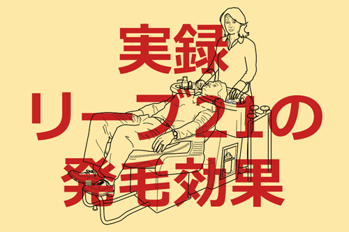 実録！リーブ21の発毛効果と価格