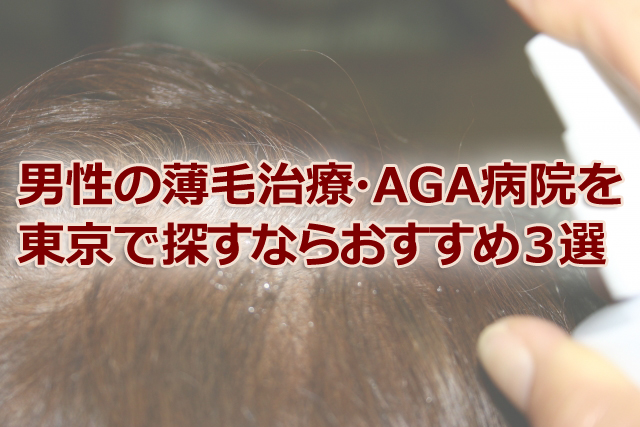 男性の薄毛治療・AGA病院を東京で探すならおすすめ３選