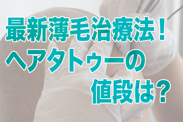 最新薄毛治療法！ヘアタトゥー（メディカルSMP）の値段は？