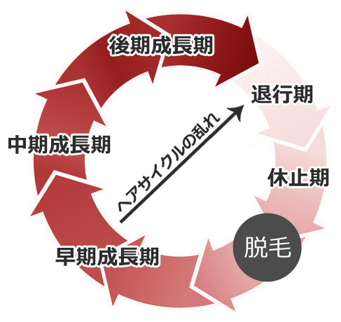 男性の薄毛の直接的な原因〜へアサイクルを改善する〜