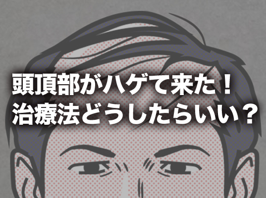 頭頂部がハゲて来た！治療法どうしたらいい？