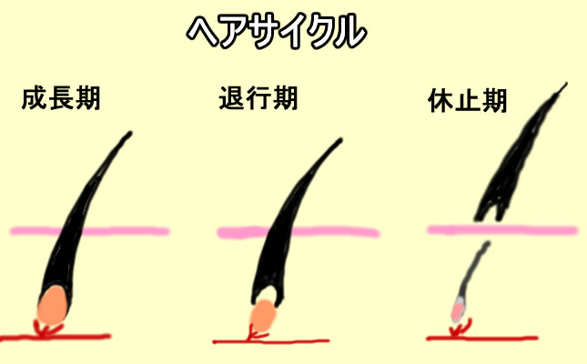 女性の薄毛危険度チェック