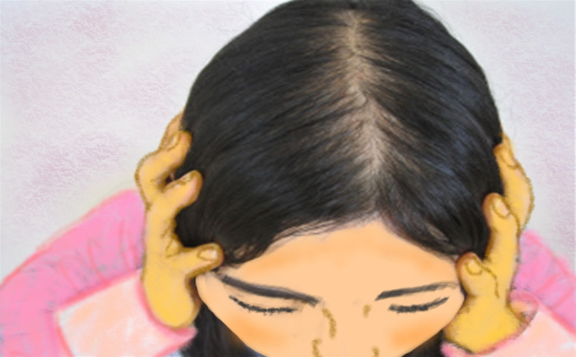 びまん性脱毛症ってナニ？治療が必要なの？